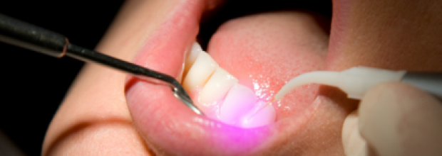 Laser regt Dentin zum Wachsen an